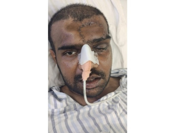 Help My Husband Sreeraj MS Recover From a Life-Threatening Accident