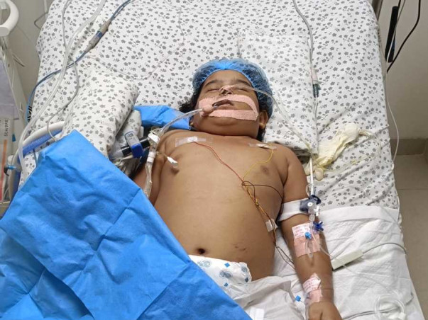 Help my daughter fight Multiorgan dysfunction syndrome