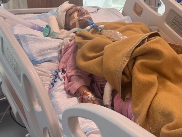 Support Sweta Singh Recover From Brain Edema