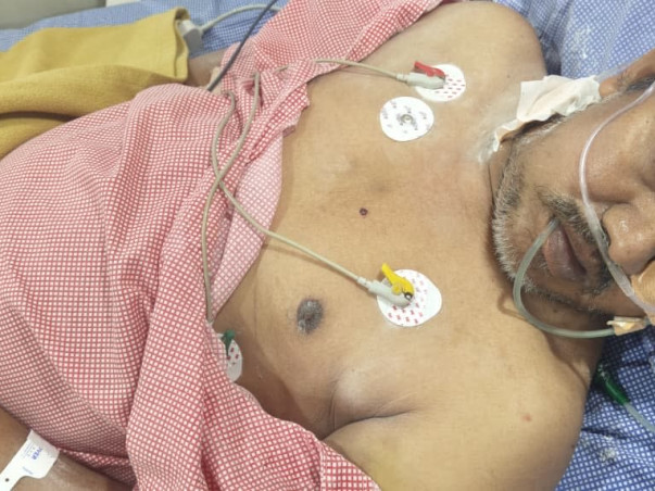Help Save My Father Raju From a Brain Aneurysm 🙏