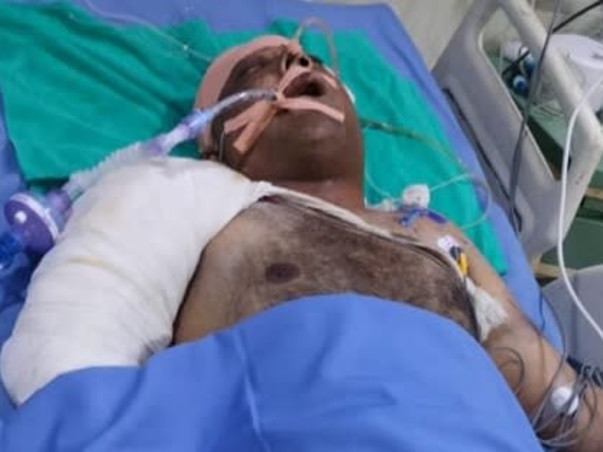 My father is struggling with Accident (severe brain injury)