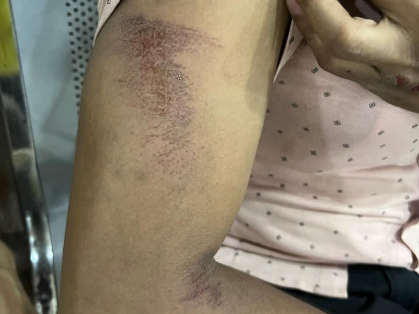 Help My Brother Palash Recover from a Severe Accident