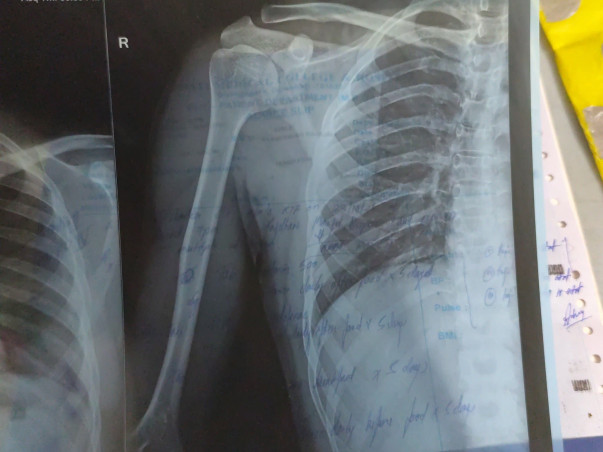 Help My Brother Palash Recover from a Severe Accident