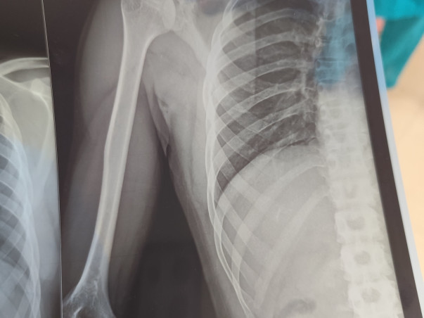 Help My Brother Palash Recover from a Severe Accident