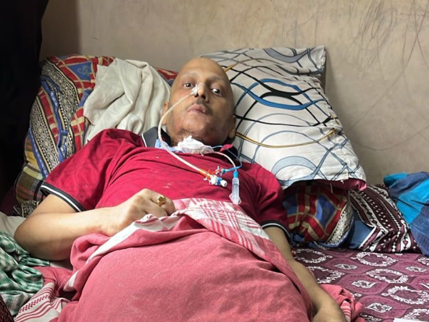 This 42 years old needs your urgent support in fighting Tongue Carcinoma