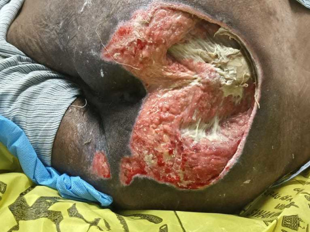 Support Adish Jain To Recover From Spinal Cord Injury