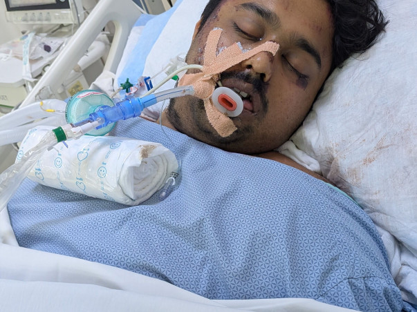 Help Save Harshith – Critical Brain Injury After Devastating Accident