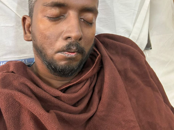 Help my husband fight Accident(Multiple Fractures/Polytrauma)