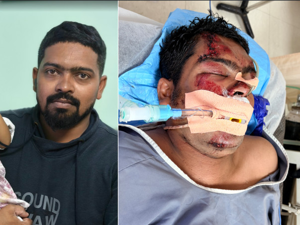 Please help my brother fight Accident(Head Injuiry / Brain Injury)