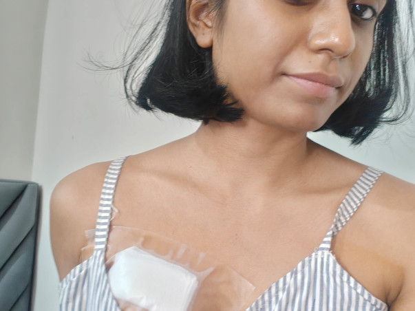 URGENT APPEAL: Help 33-Year-Old Madhurima Defeat HER2-Positive Breast