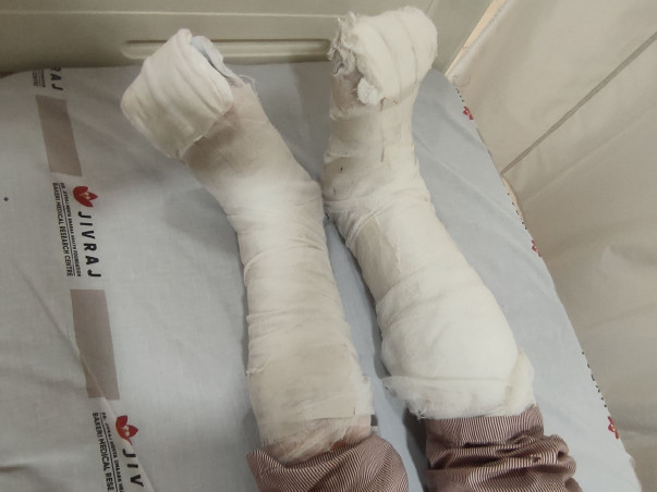 Urgent Surgery Needed: Help Save My Brother’s Legs from Amputation