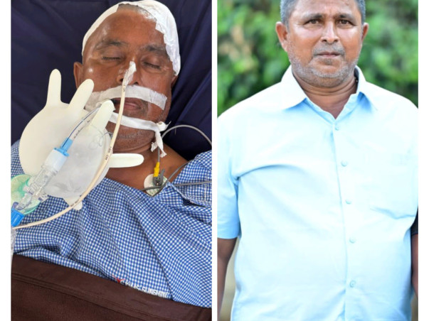 Help My Father Fight Critical Brain Stroke Treatment.