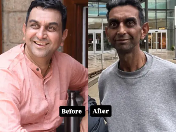 Help Save Ravi Mudumbe – Urgent Liver Transplant Needed