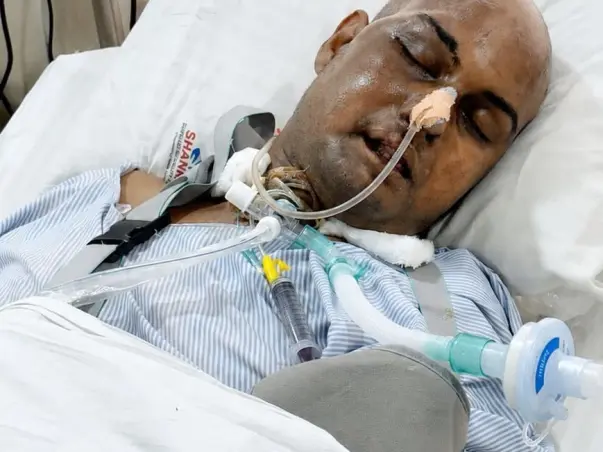 Critical Brain Injury – Your Support Can Save Him