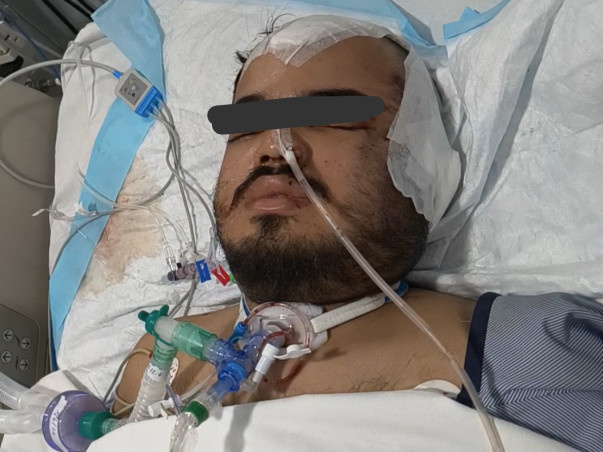 This 24 years old needs your urgent support in fighting Accident(Head Injuiry / Brain Injury)
