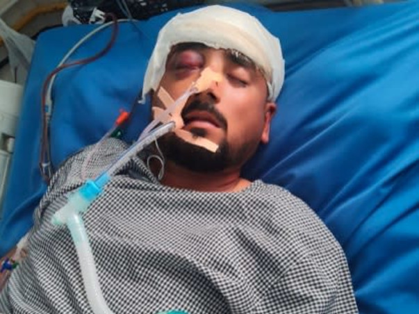 Help Hemant Fight for His Life After a Tragic Accident