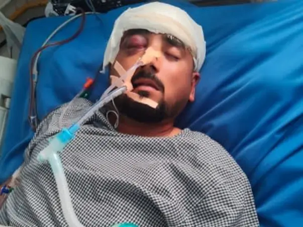 Help Hemant Fight for His Life After a Tragic Accident