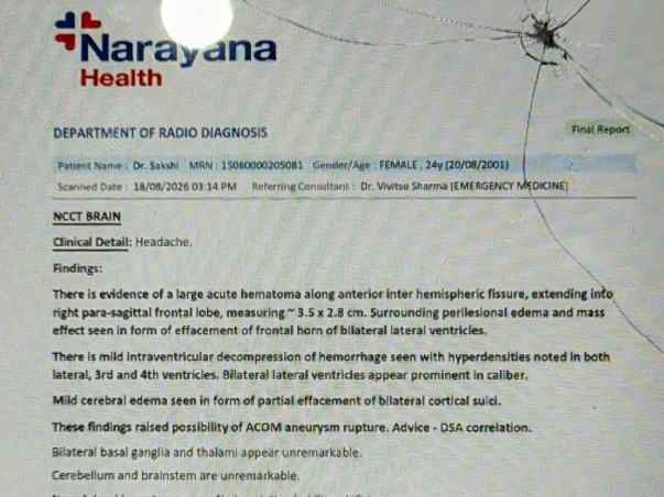 Help save my sister's life - she needs urgent brain surgery