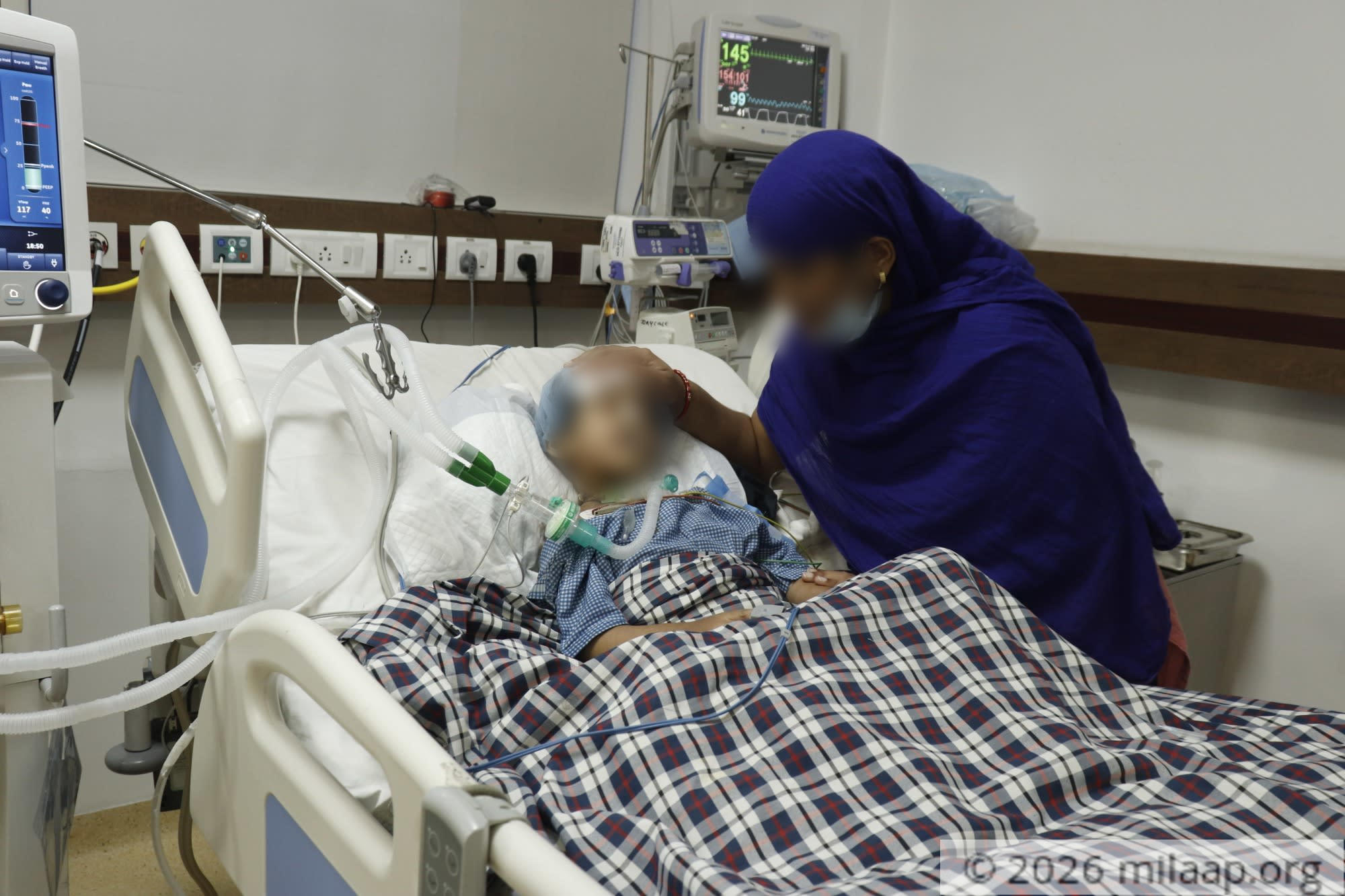  mg 3251 kgtbx5 1594892584