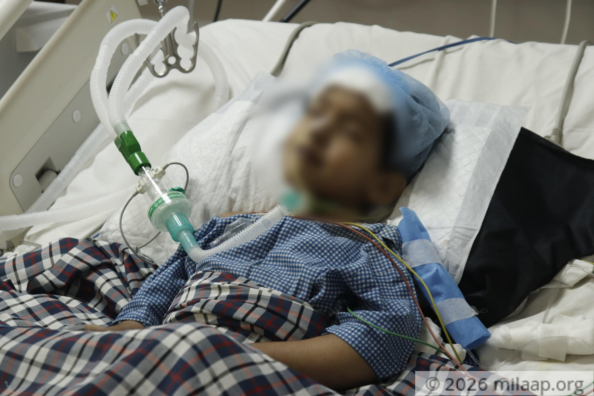  mg 3268 hivbhu 1594893991