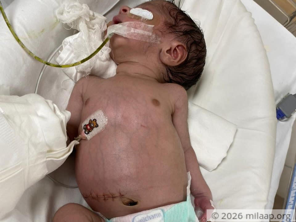 Whatsapp image 2020 07 21 at 3.50.47 pm sjzvwi 1595326933