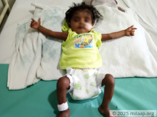 Help baby Monasree fight a severe heart disease
