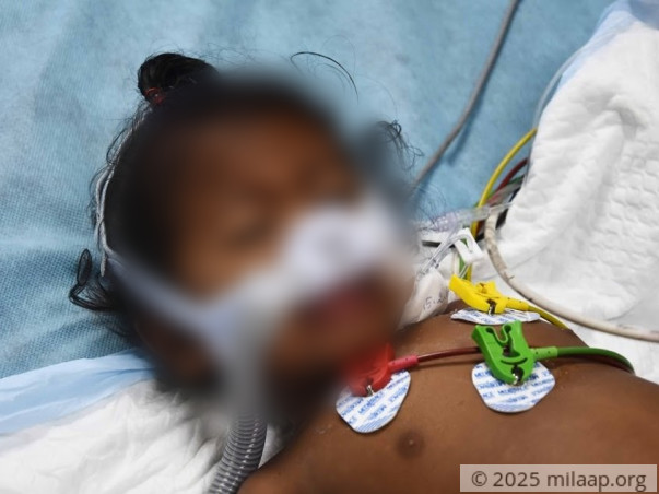 Help 11-month-old Kabelish Fight Pneumonia And Breathe Again