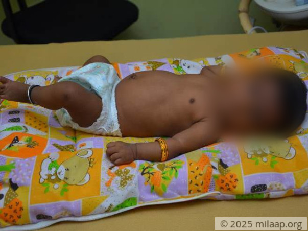 Help Parimala save her one month old baby girl
