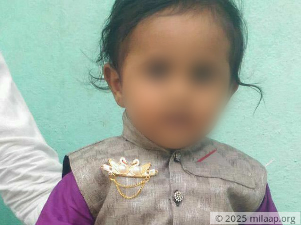 50% Of This Baby’s Body Is Burnt And He’s Struggling To Live