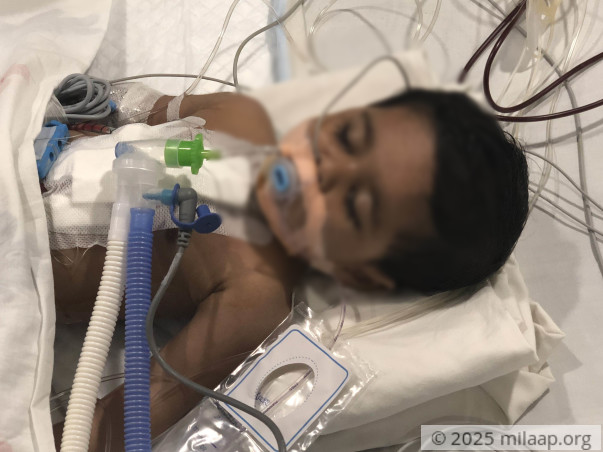 Help 1-year-old Pari fight a severe heart disease