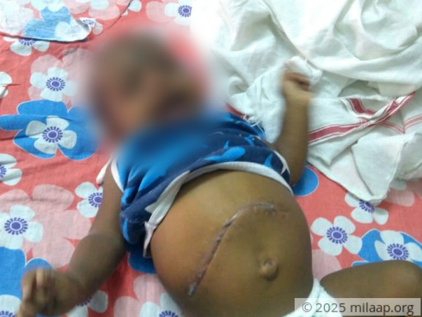 My 5-month-old Son Cries Out Of Pain Even If We Touch Him