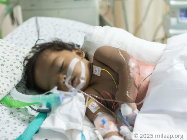 65% Of This Baby’s Body Is Burnt And He’s Struggling To Live