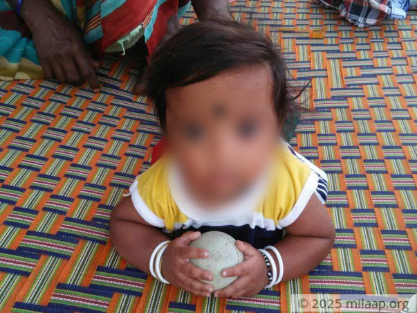 65% Of This Baby’s Body Is Burnt And He’s Struggling To Live