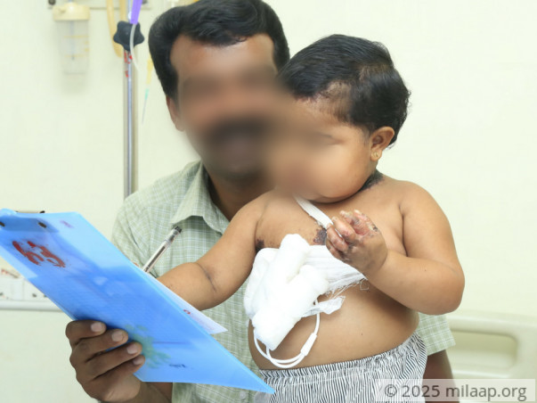 3-year-old Ancelet Will Die Like Her Siblings Without Urgent Help