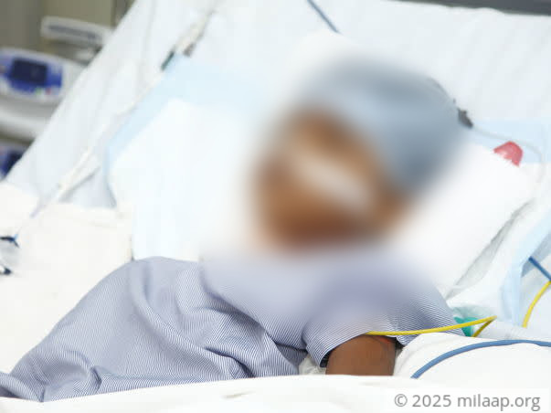 She Might Lose Her Life Any Moment To Seizures And Brain Infections