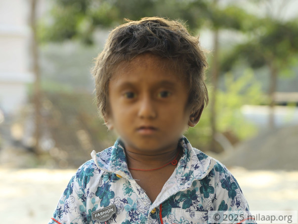 Badukonda needs your help to undergo liver transplant