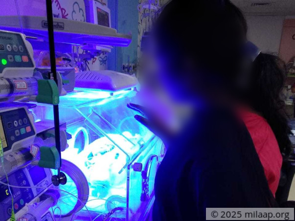 Baby of Vinod needs your help to survive