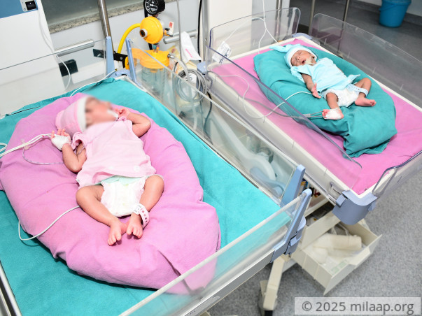 These Babies Have Not Been Home Since Birth, They Need Treatment