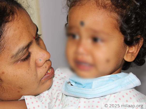 Cancer Has Stolen This 2-Year-Old's Smile, Needs Urgent Help To Live