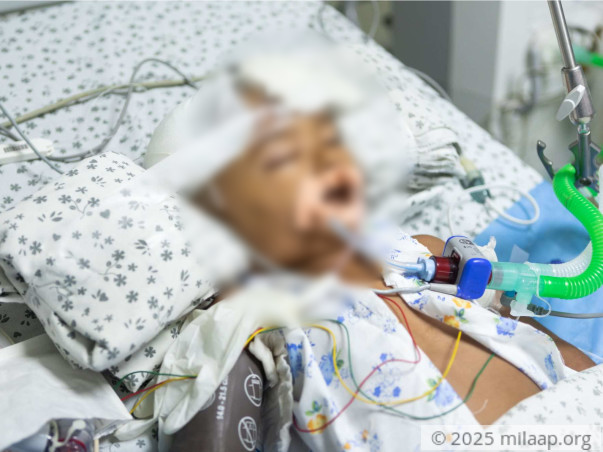 Help Aradhya Undergo An Urgent Decompressive Craniotomy