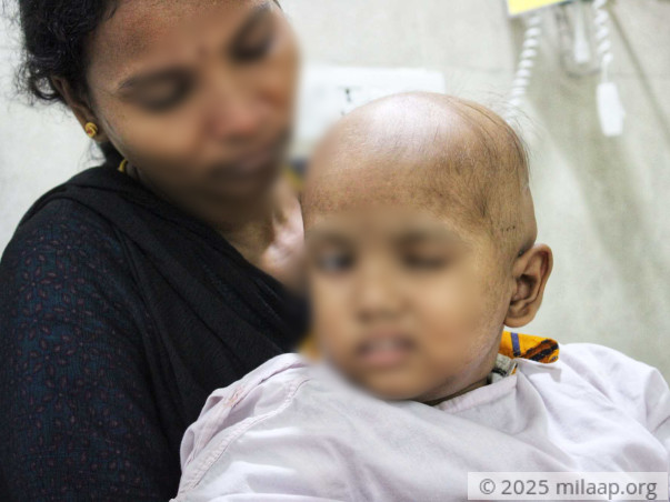 The Scar On His Head Is Proof Of His Pain, Brain Tumor Will Kill Him
