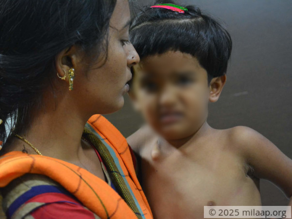 Help Keerthana Fight Kyphoscoliosis