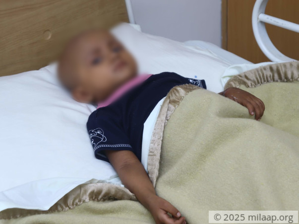 1-Year-Old Had A 1Kg Cancerous Tumour, It Can Kill Her Without Help