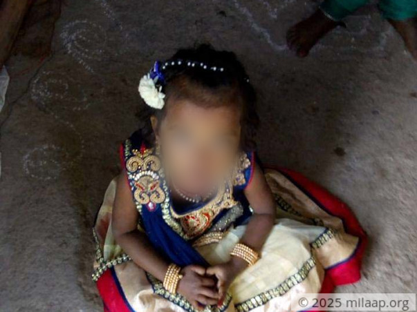 4 year old Padmini has been in coma and need your support to survive