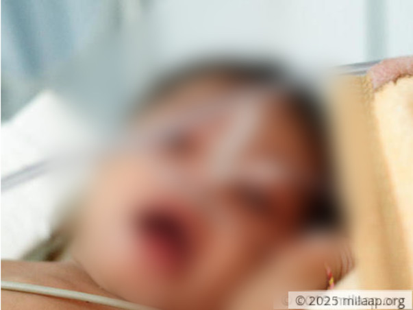 Help Krishna Kant Recover With Intra Cardiac Repair