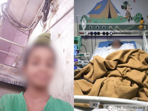 My Son's Body Is 60% Burnt And He Needs Your Help To Survive