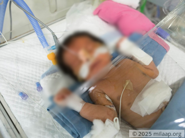 Help Swathi's Preterm Baby Survive