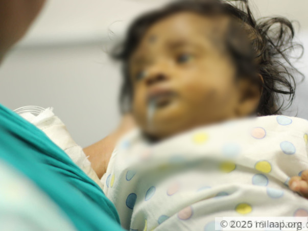 This 4-Month-Old Baby Girl Can Lose Her Life To Liver Failure