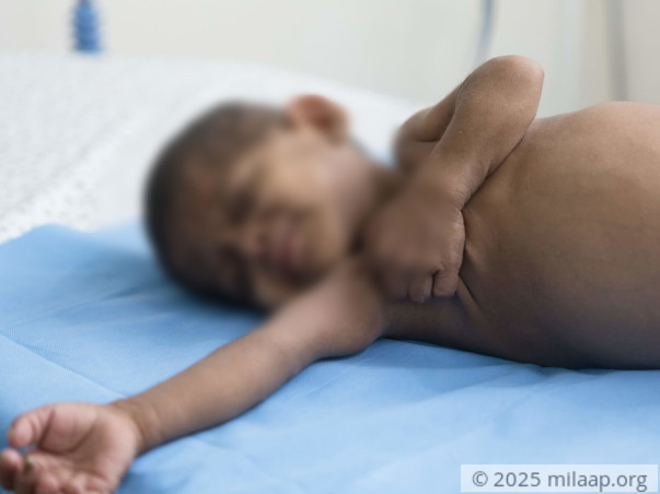 Her Condition Makes This 2-year Old Scratch Herself So Hard She Bleeds