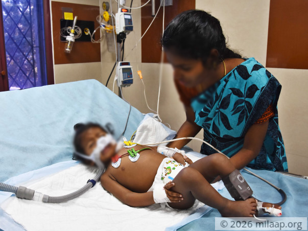 Help 11-month-old Kabelish Fight Pneumonia And Breathe Again